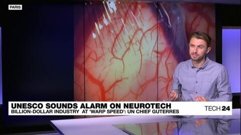 Mind control: Top neurotech firms can hoard and share patients' brain data